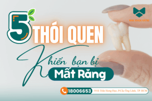 Mất răng