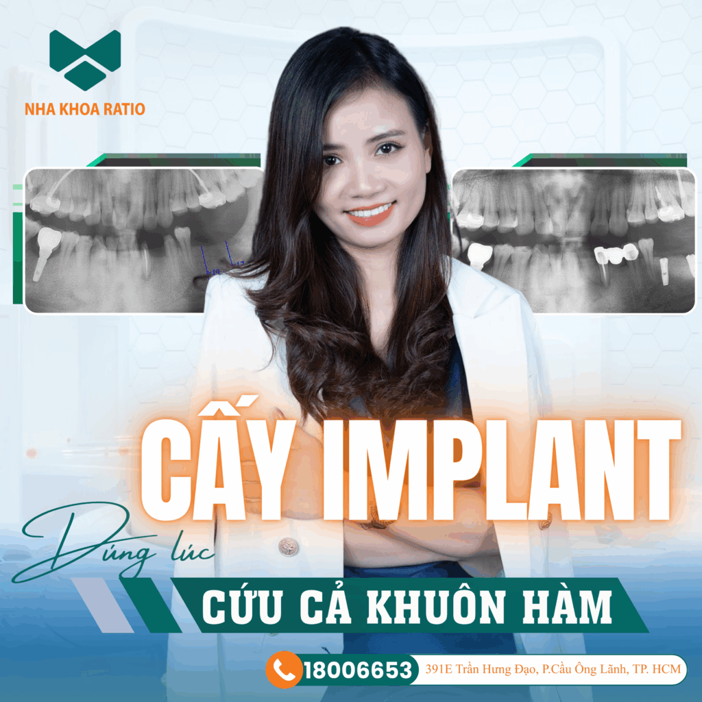 mất răng lâu năm