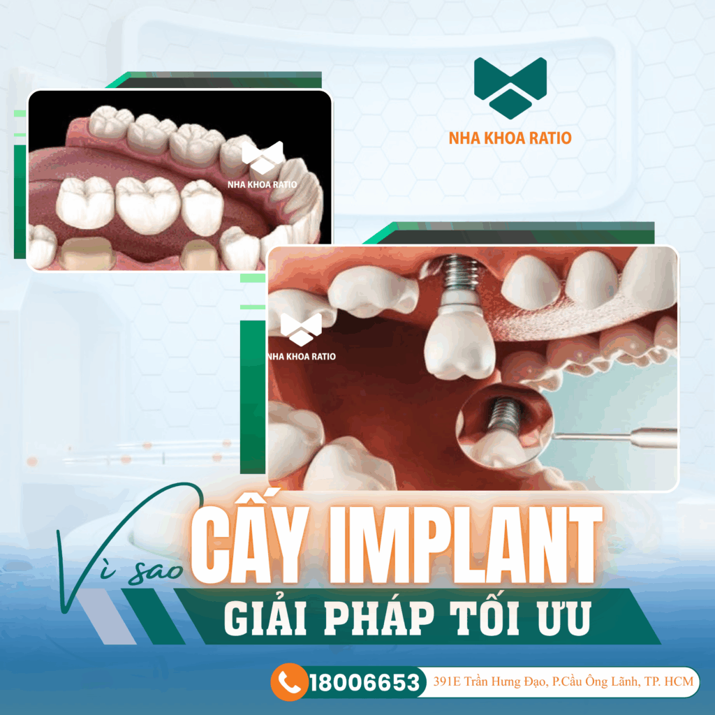 mất răng lâu năm