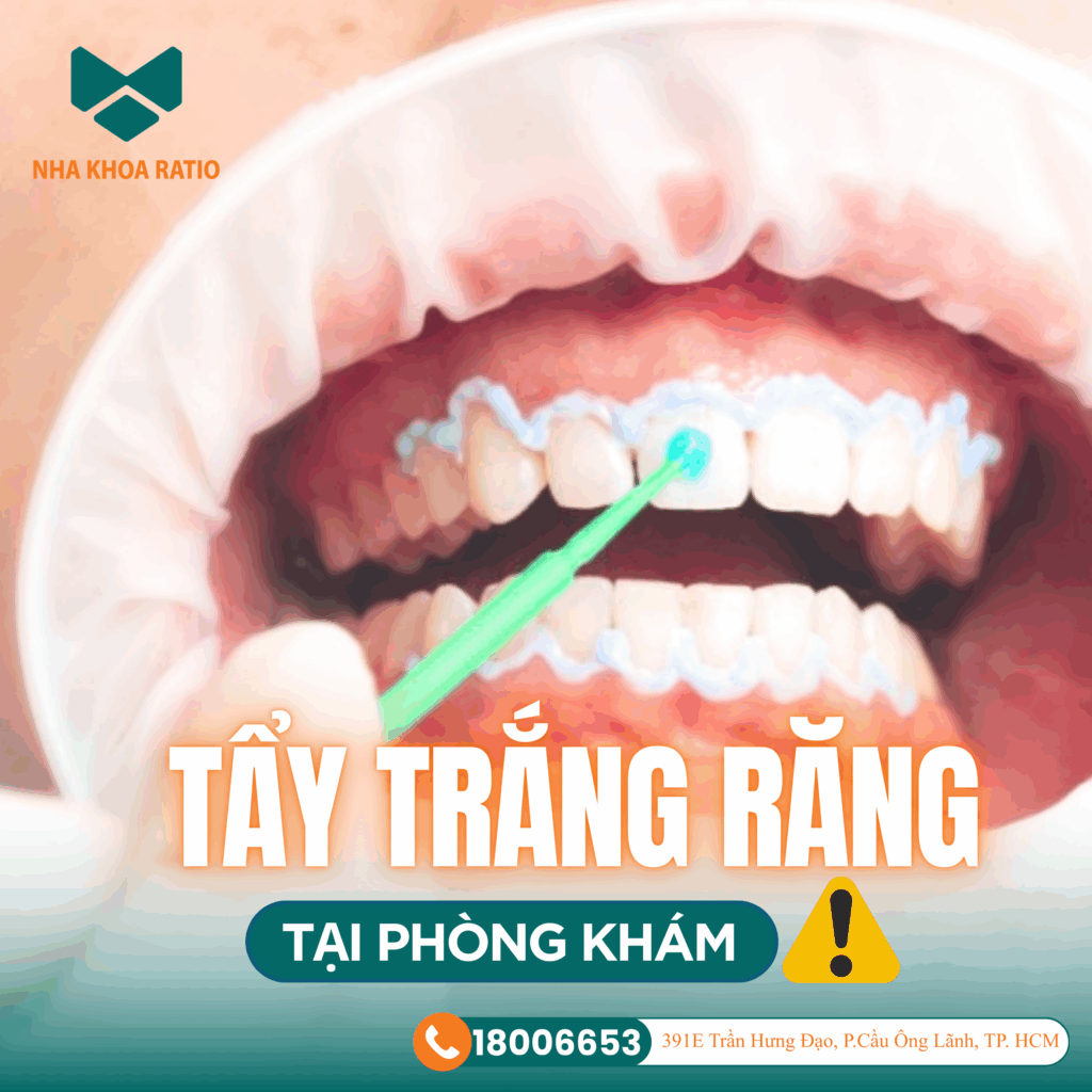 tẩy trắng răng tại phòng khám