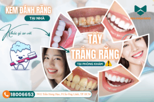 tẩy trắng răng