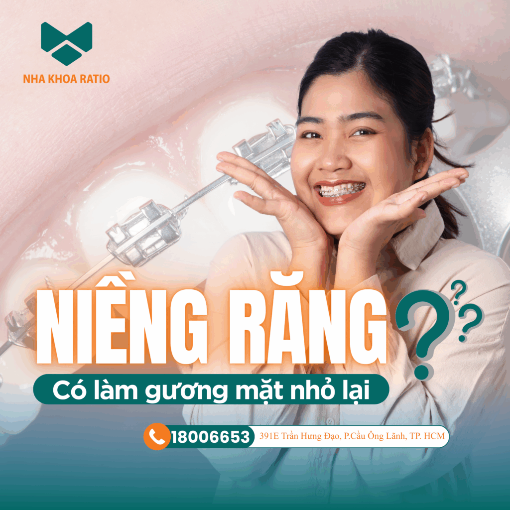 niềng răng , Nha khoa Ratio 