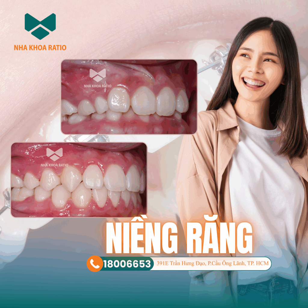 niềng răng , Nha khoa Ratio 
