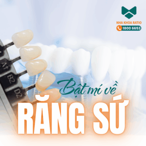 Răng sứ Nha khoa Ratio