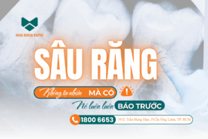 Sâu răng - Nha khoa Ratio