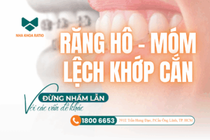 Nha khoa Ratio - răng hô móm lệch khớp cắn