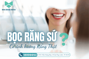 Bọc răng sứ