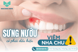 Sưng nướu