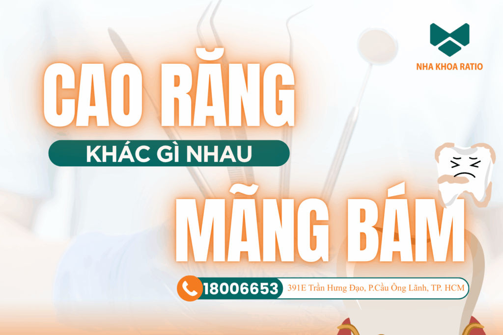 Nha khoaRatio - cao răng mãng bám