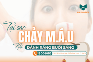 chảy máu khi đánh răng nha khoa Ratio