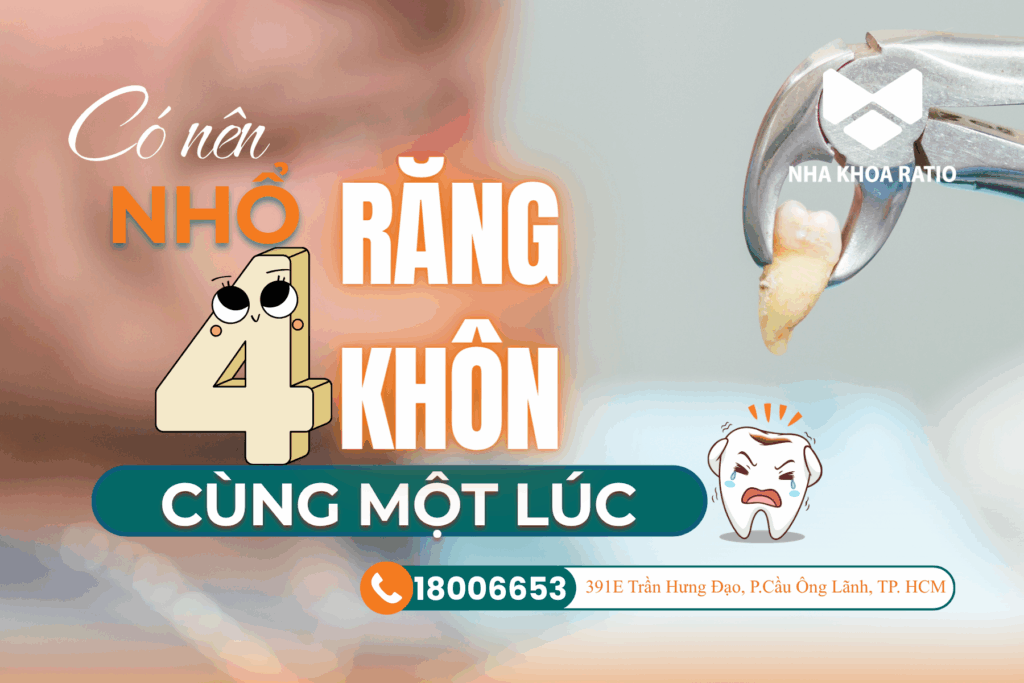 Răng khôn - Nha Khoa Ratio