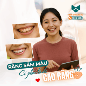 Răng sẫm màu Nha Khoa Ratio