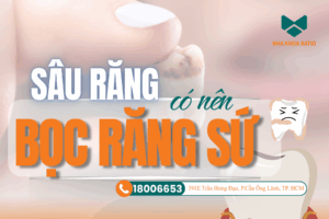 Sâu răng có nên bọc răng sứ Nha Khoa Ratio