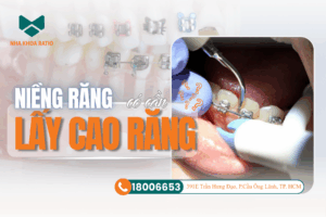 Niềng răng nha khoa Ratio