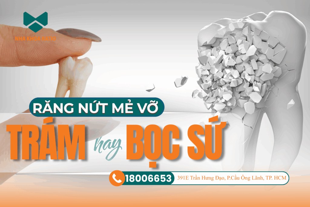 Răng nứt mẻ vỡ