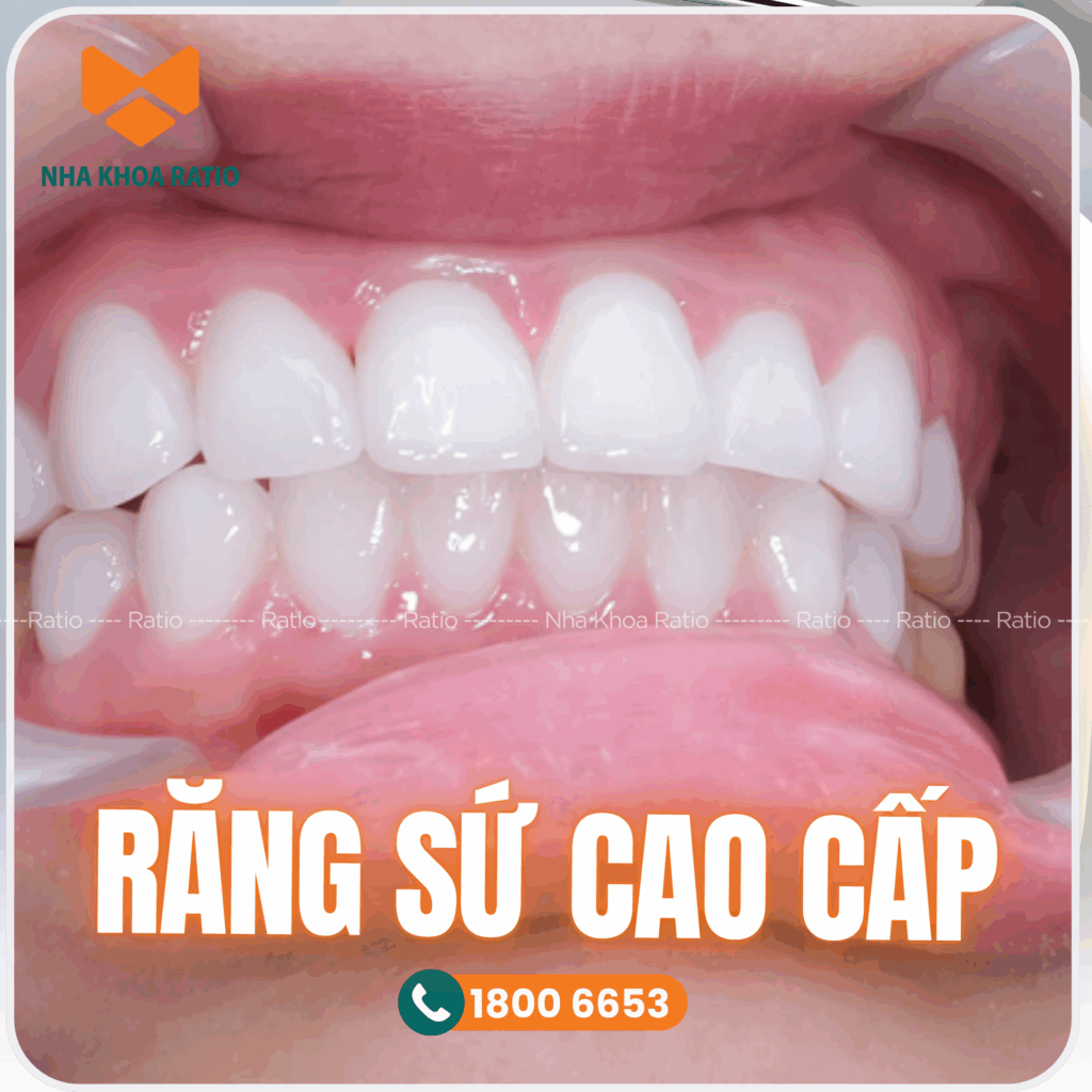 Răng sứ cao cấp nha khoa Ratio