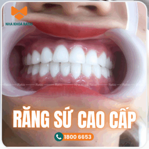 Răng sứ cao cấp nha khoa Ratio