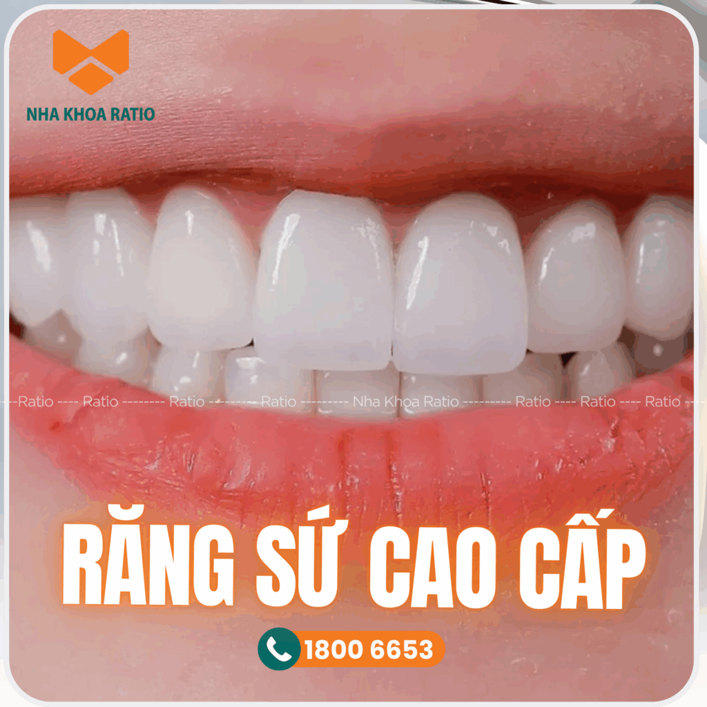 Răng sứ cao cấp nha khoa Ratio