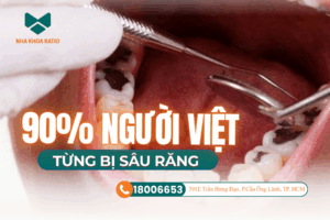 Sâu răng nha khoa Ratio