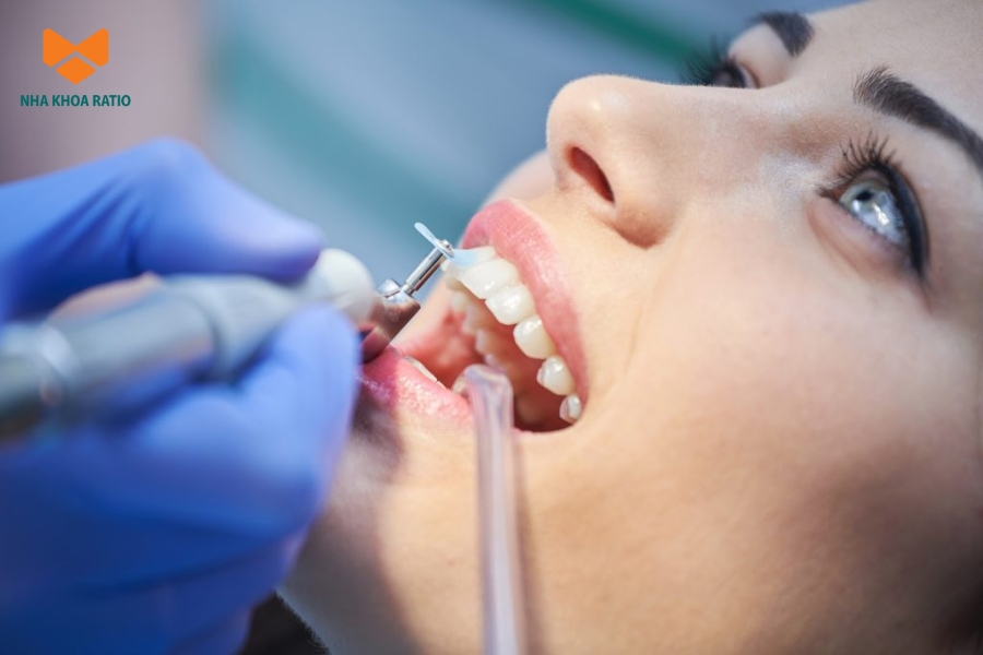 Bạn nên cạo vôi răng mỗi 3 đến 6 tháng một lần tùy vào tình trạng răng