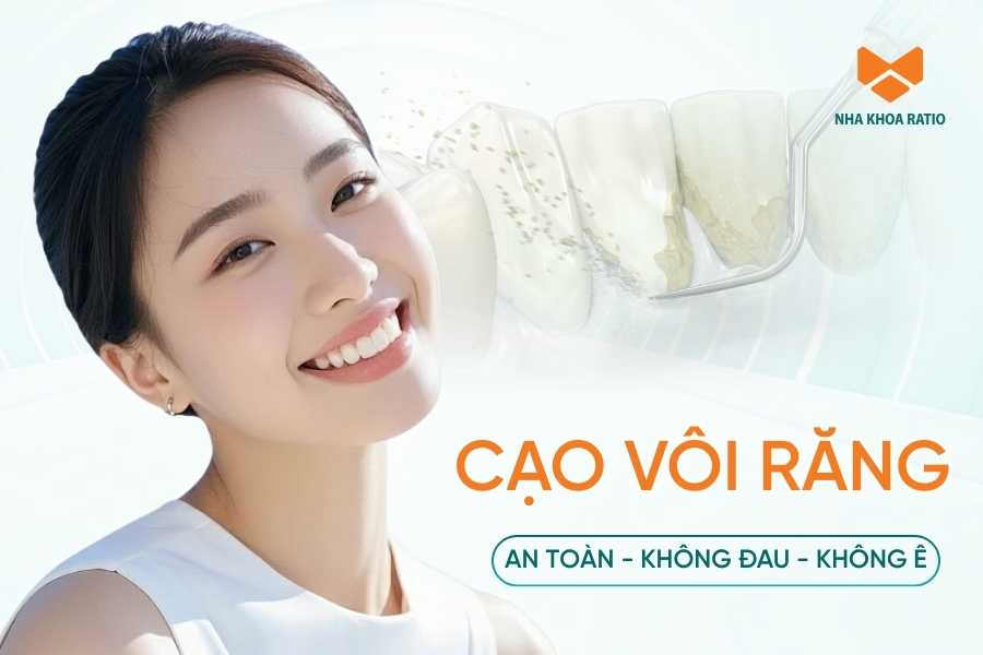 Cạo vôi răng an toàn, chuẩn Y Khoa tại Nha khoa Ratio