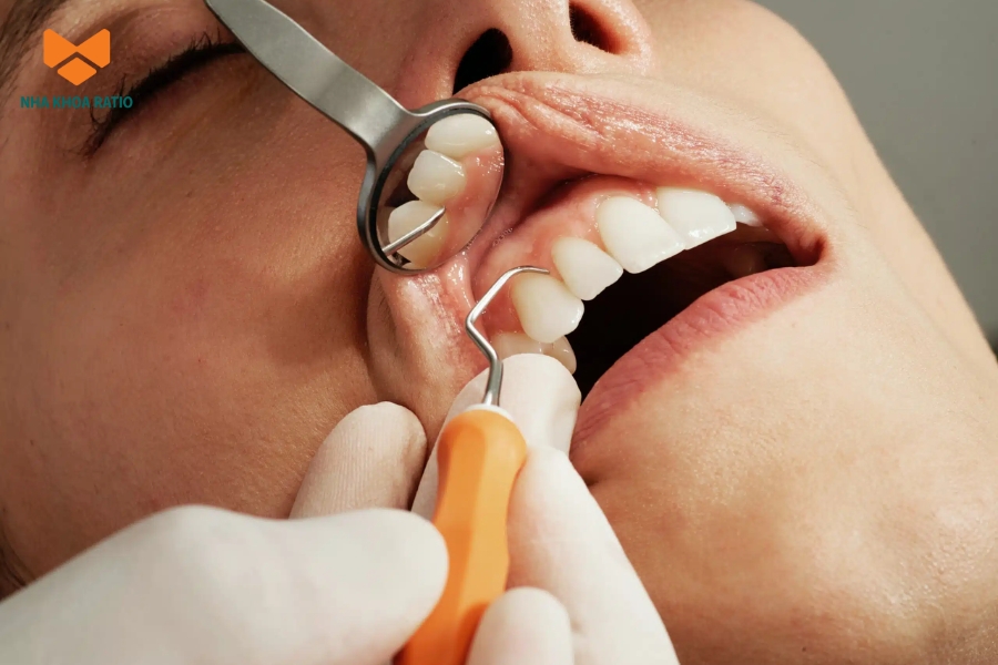 Theo khuyến nghị, khách hàng nên cạo vôi răng định kỳ để bảo vệ sức khỏe răng miệng