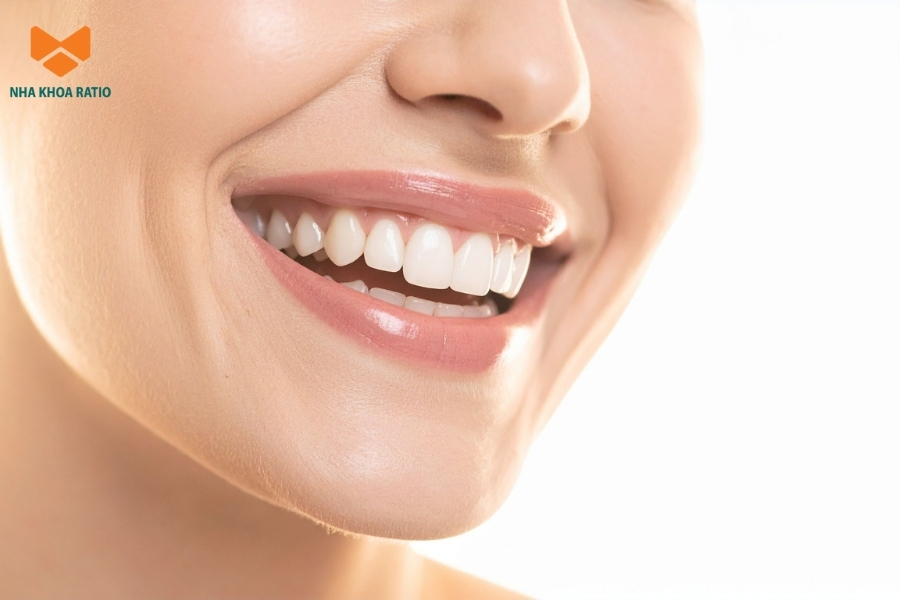 Bạn có thể cân nhắc tẩy trắng răng khi muốn làm sáng màu răng an toàn