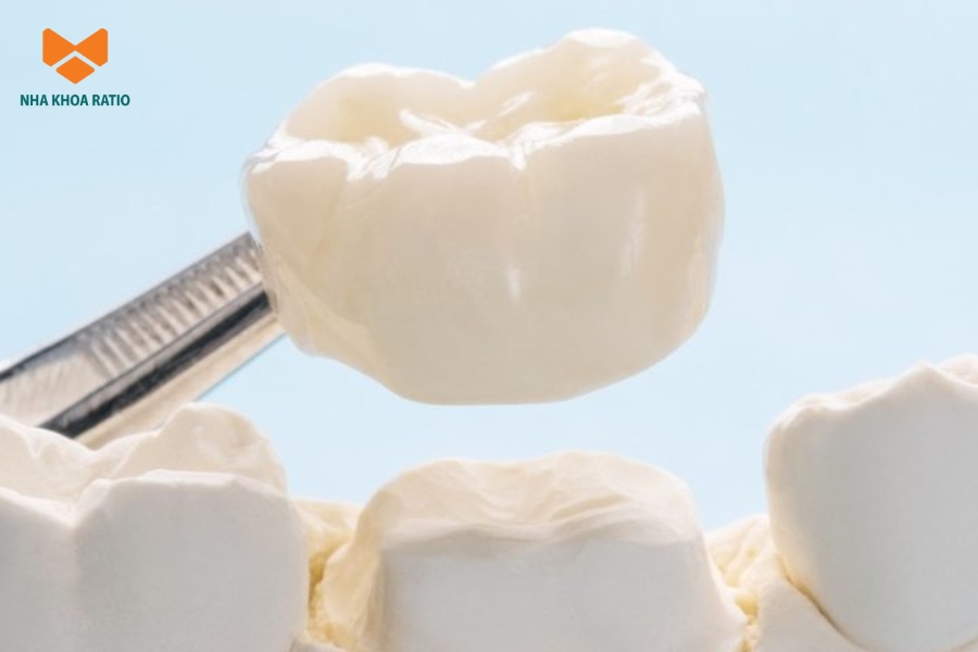 Răng sứ giúp bao phủ và bảo vệ răng thật, hạn chế hư tổn tiến triển và giữ cấu trúc răng ổn định Răng sứ giúp bao phủ và bảo vệ răng thật, hạn chế hư tổn tiến triển và giữ cấu trúc răng ổn định