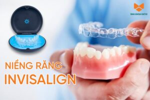 Niềng răng Invisalign trong suốt tàng hình – Chỉnh nha thoải mái cho nụ cười đẹp