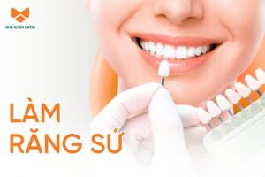 Răng sứ – Giải pháp thẩm mỹ giúp nụ cười đều đẹp và tự tin hơn