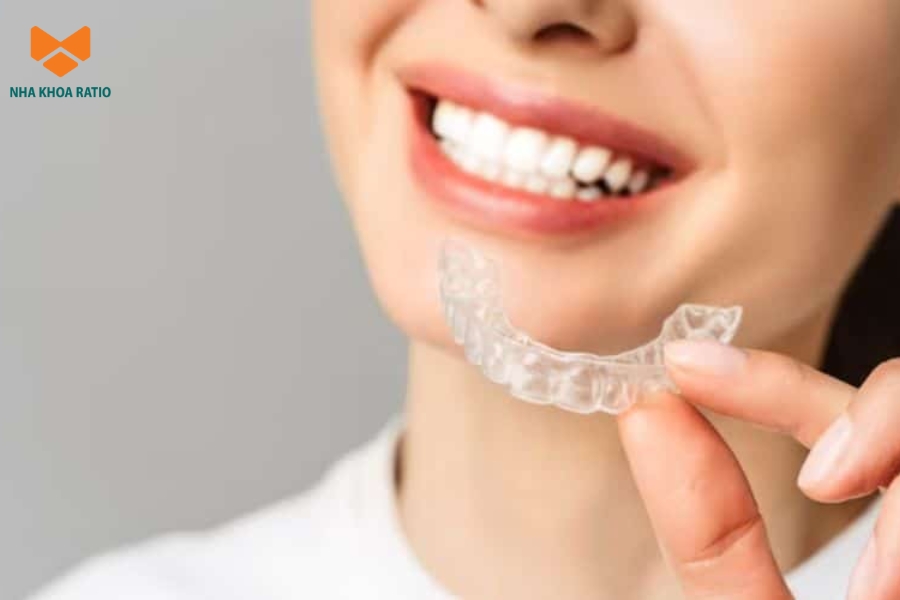 Ngưỡng chịu đau của từng người cũng ảnh hưởng đến việc niềng răng không mắc cài có đau không