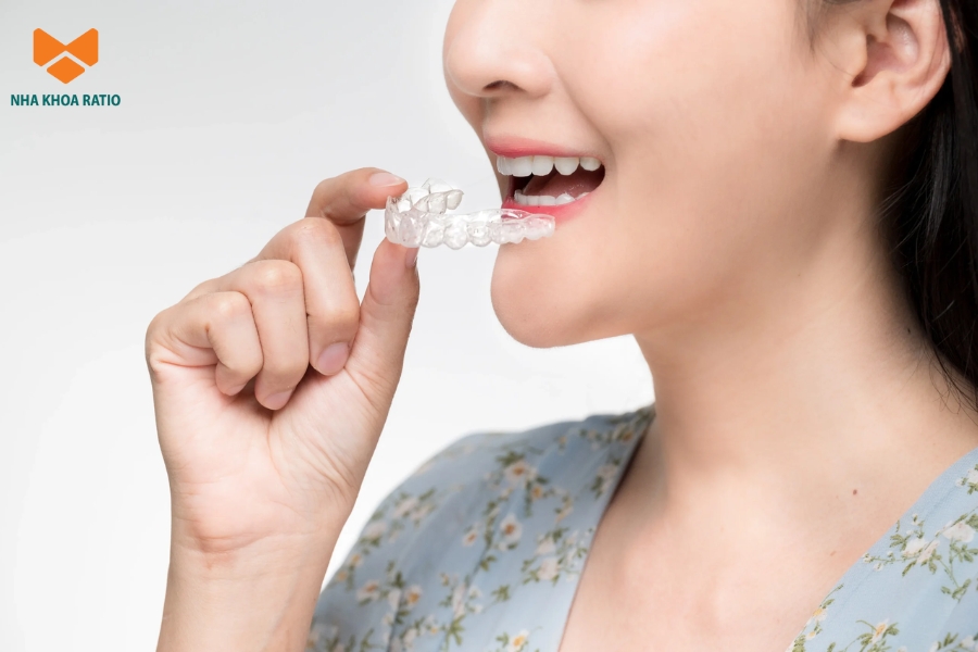 Khách hàng nên chọn cơ sở uy tín khi niềng răng trong suốt để quá trình diễn ra an toàn, đúng kế hoạch Khách hàng nên chọn cơ sở uy tín khi niềng răng trong suốt để quá trình diễn ra an toàn, đúng kế hoạch