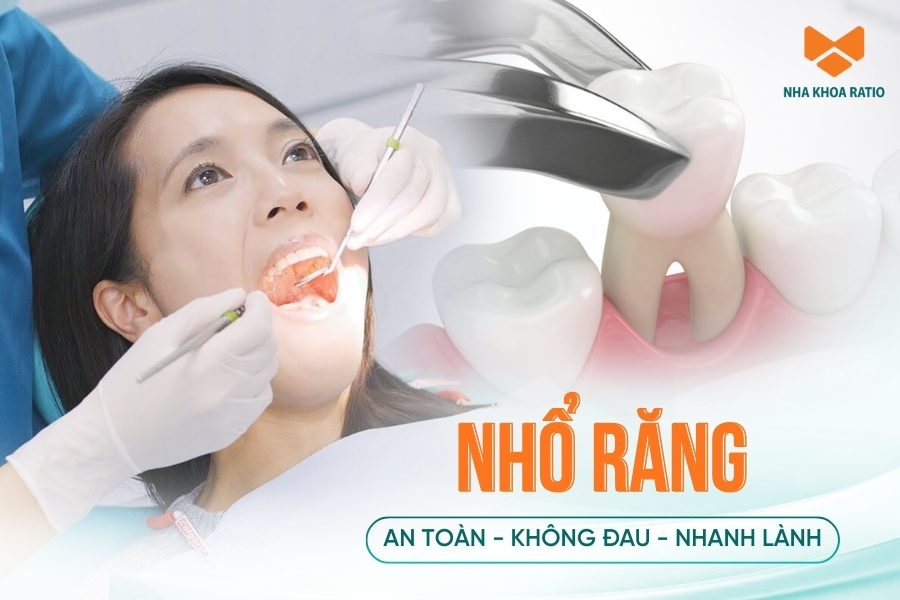 Nhổ răng: Đối tượng chỉ định, quy trình và một số lưu ý
