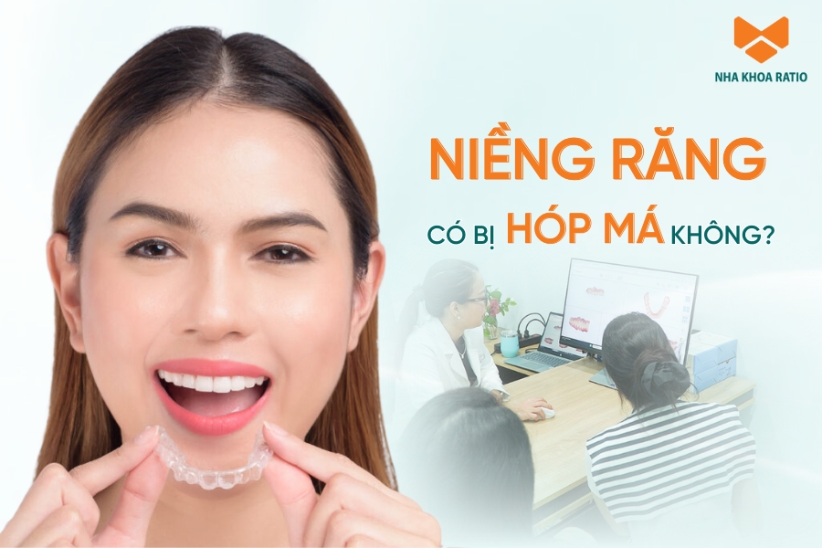 Niềng răng có bị hóp má không? Nguyên nhân và cách khắc phục