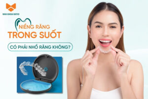 Khi niềng răng trong suốt có phải nhổ răng không?