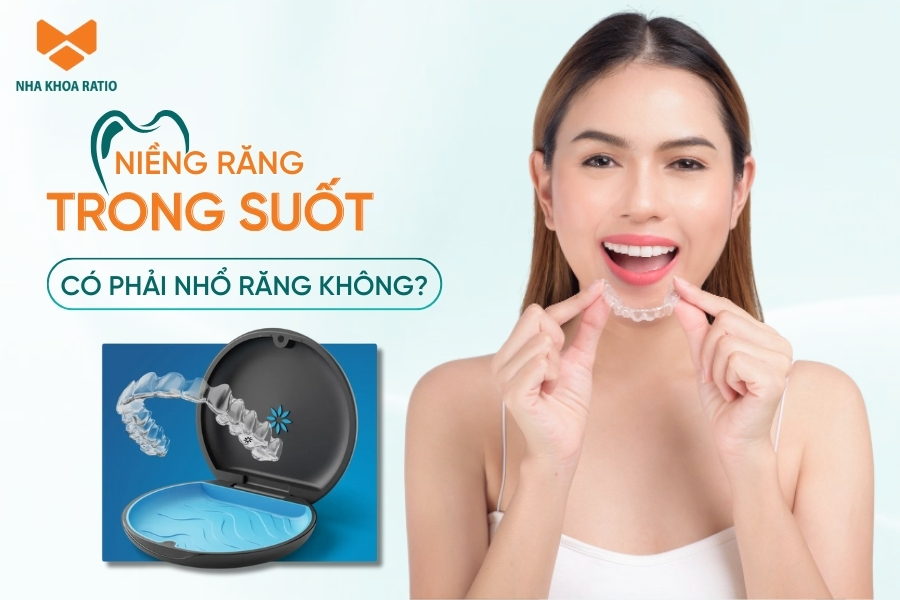 Khi niềng răng trong suốt có phải nhổ răng không?