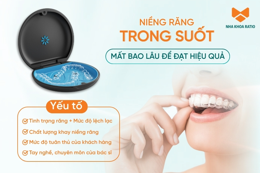 Niềng răng trong suốt mất bao lâu để đạt được hiệu quả tối ưu?