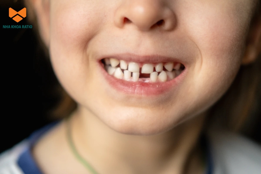 Thăm khám định kỳ giúp phát hiện sớm và phòng ngừa các vấn đề răng miệng trong giai đoạn trẻ đang phát triển.